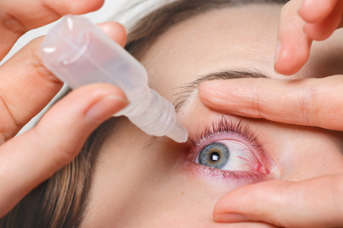 Conjunctivitis: Is It Contagious, How Long Does It Last and How Do You Treat It?