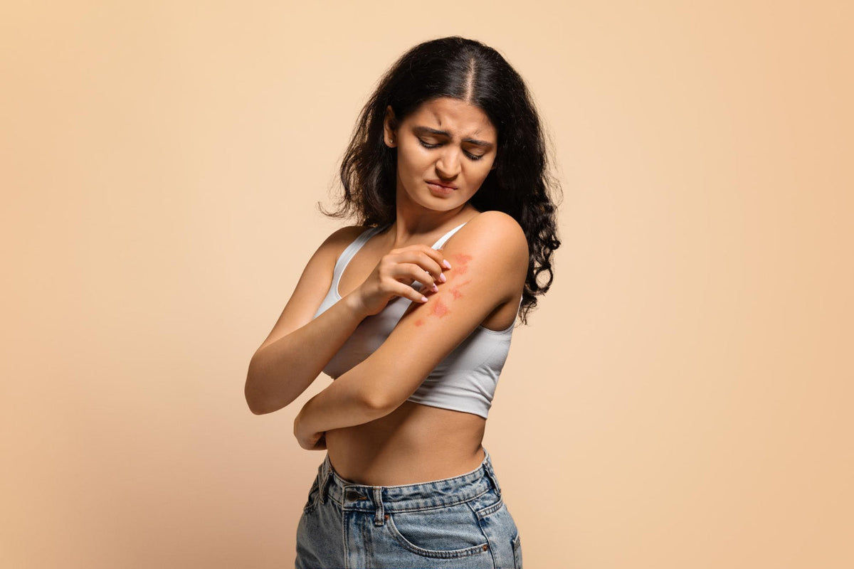 Woman in a white vest scratching a red, irritated patch of skin on her upper arm