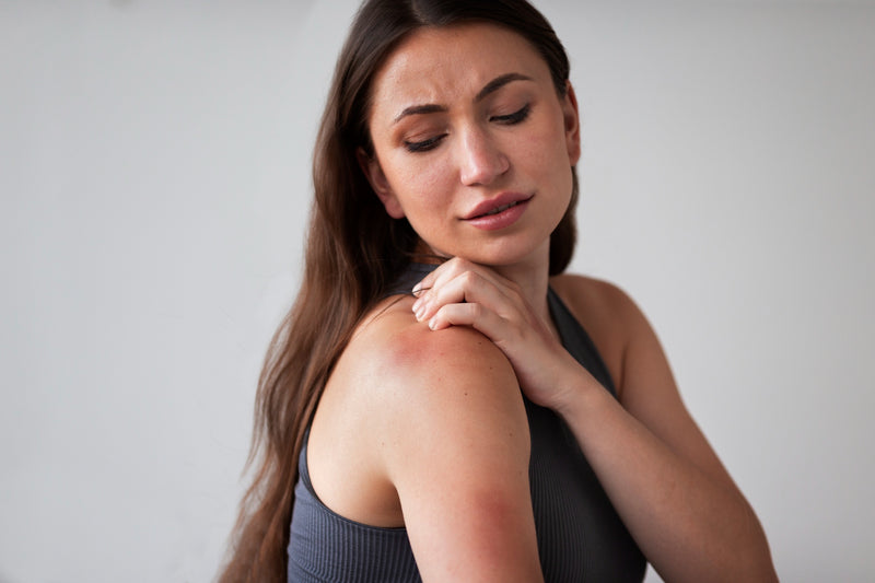 Skin Infections